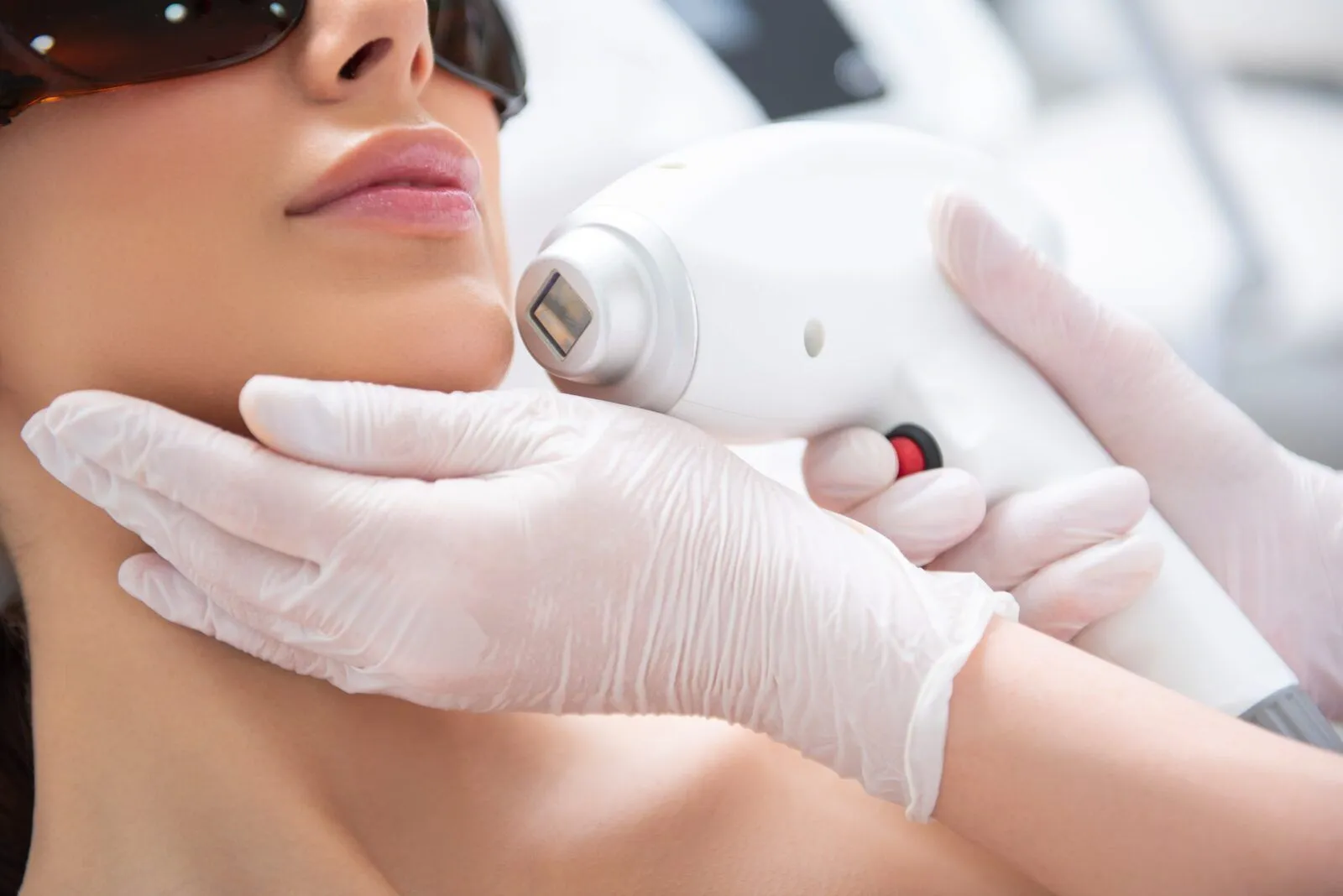 Laser Treatments